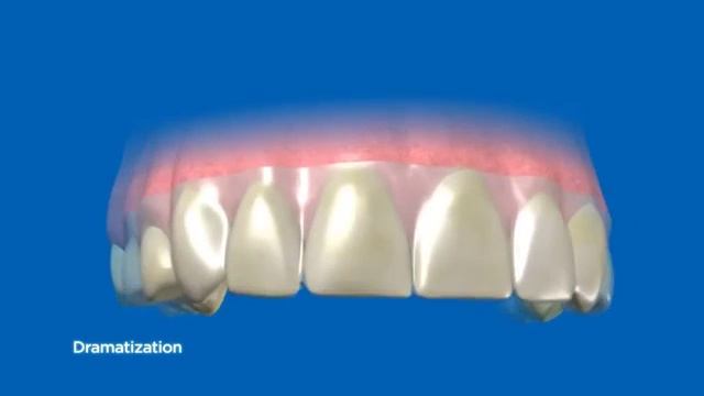 Полоски для отбеливания зубов смотреть онлайн