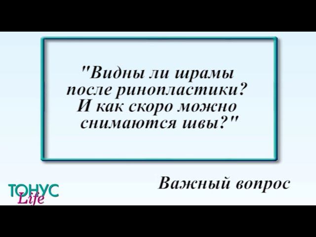 Видны ли шрамы после ринопластики? И как скоро снимаются швы? смотреть онлайн
