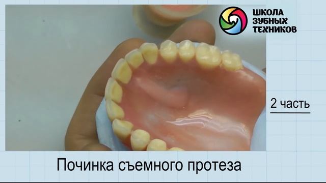 "Починка съемного протеза" часть №2 смотреть онлайн