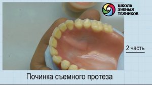 "Починка съемного протеза" часть №2