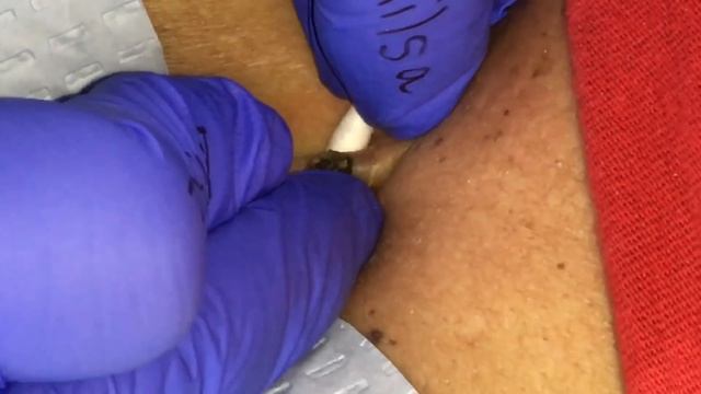 Dilated Pore of Winer смотреть онлайн