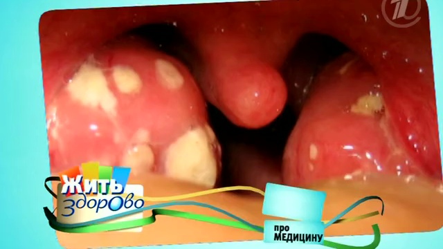 Минтай Близкий родственник трески смотреть онлайн