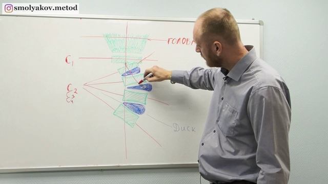 ИСКРИВЛЕНИЕ ПОЗВОНОЧНИКА