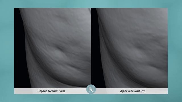 NeriumFirm FINAL 1 смотреть онлайн