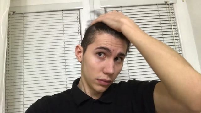 Рост волос за 10 месяц 300 дней Март 270-300 дней после нуля смотреть онлайн