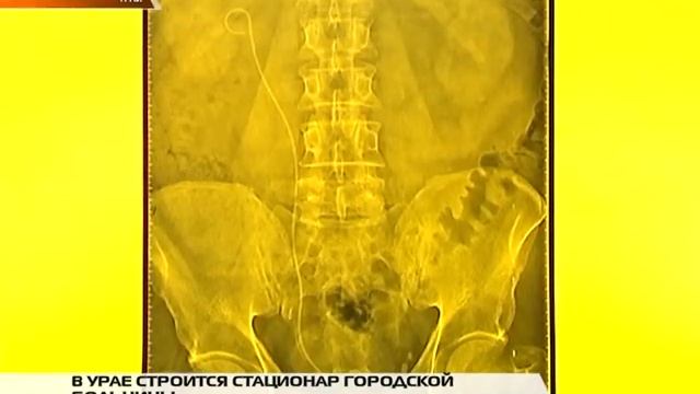 Эфир ТРК Спектр от 09 12 2014г  Строительство стационара