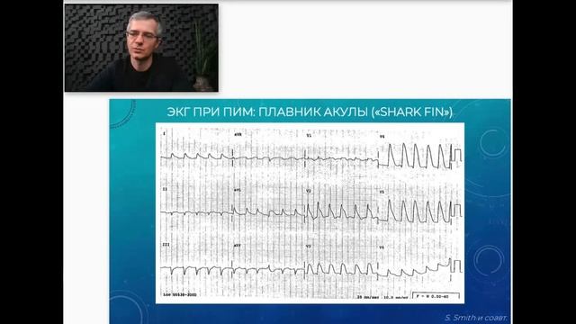 Четвертый вебинар Марафона смотреть онлайн