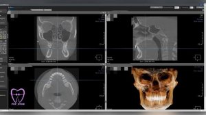 КЛКТ в стоматологии. Как смотреть КТ