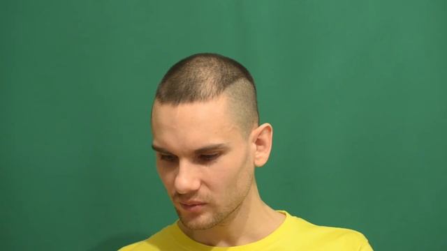 Жирная кожа ЛИЦА | Сухая кожа | Сохнут руки - что делать!?