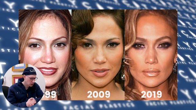 Jennifer Lopez NEW FACE | Plastic Surgery Analysis