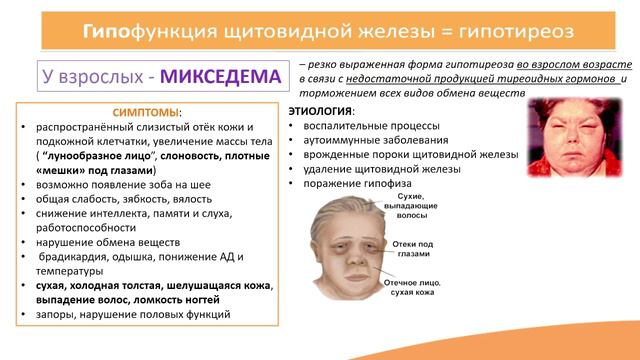 6.2. Заболевания щитовидной и паращитовидных желёз смотреть онлайн