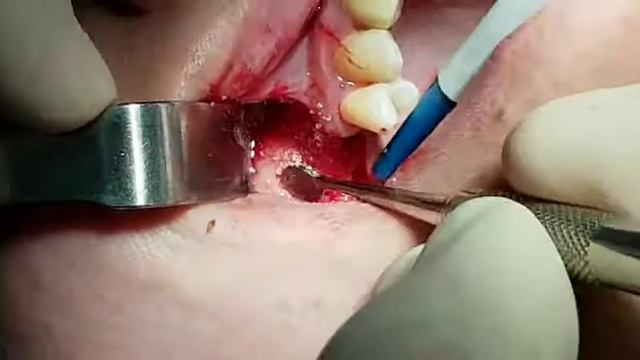 PAG 136 Video 13 смотреть онлайн