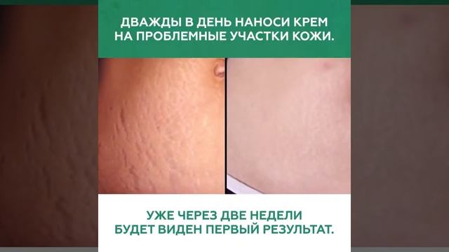 Красота из аптеки за копейки смотреть онлайн