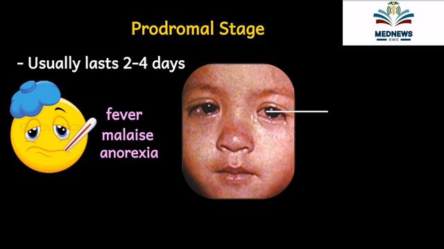 Unbelievable! All FACTS ABOUT MEASLES you need to know смотреть онлайн