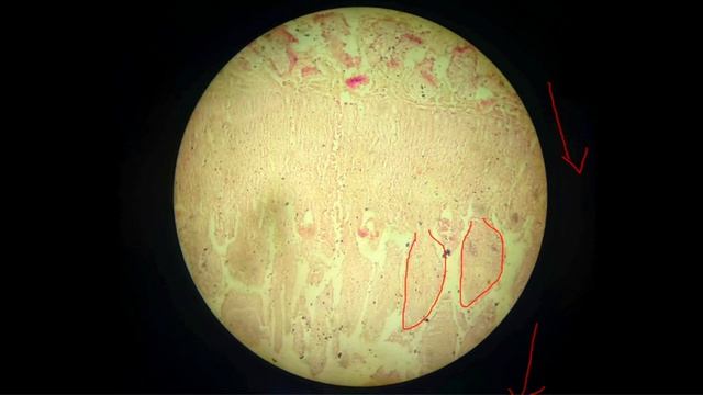 GIT Histology | LUCKY SLIDE | TONGUE | OESOPHAGUS | DUODENUM | ILEUM | LARGE INTESTINE | সহজ বাংলায় смотреть онлайн