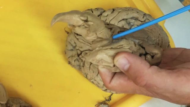 Промежуточный мозг - diencephalon; разбор препарата смотреть онлайн
