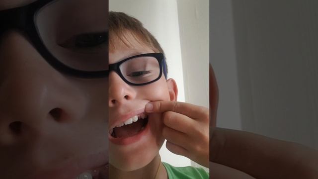 у меня выпал зуб смотреть онлайн