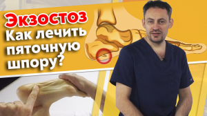 Почему болит пятка?
Экзостоз пяточной кости. Массаж при пяточной шпоре.