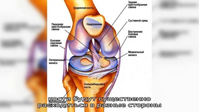 Перелом коленной чашечки