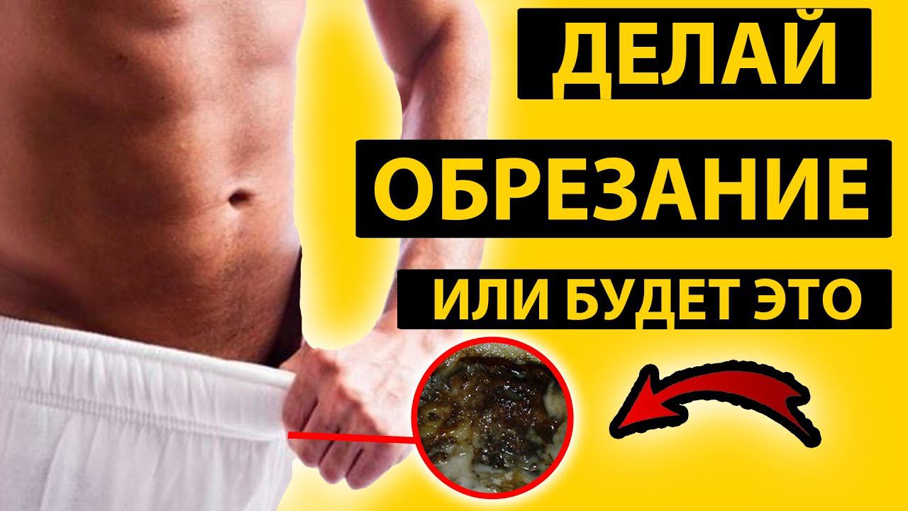 ЗАЧЕМ МУЖЧИНЫ ДЕЛАЮТ ОБРЕЗАНИЕ? ПЛЮСЫ И МИНУСЫ. С КЕМ ЛУЧШЕ?