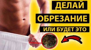 ЗАЧЕМ МУЖЧИНЫ ДЕЛАЮТ ОБРЕЗАНИЕ? ПЛЮСЫ И МИНУСЫ. С КЕМ ЛУЧШЕ?