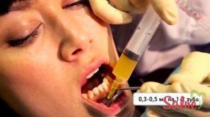 Плазмолифтинг в стоматологии. В Сургуте новшество "лечение десен своей кровью"