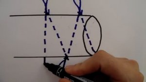 Сухожильный шов Кюнео