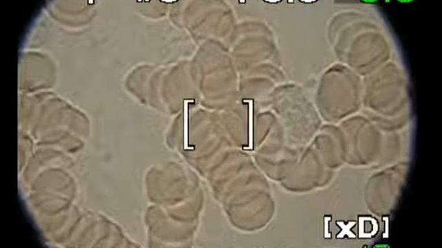 18 Активный лейкоцит