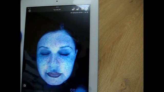 диагностика кожи лица на аппарате Observ 520 смотреть онлайн