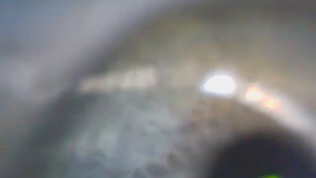 глаз человека под микроскопом смотреть онлайн