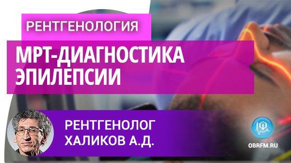 Рентгенолог Халиков А.Д.: МРТ-диагностика эпилепсии смотреть онлайн