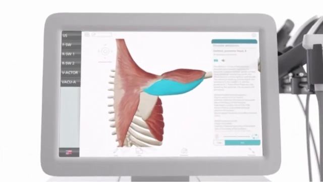 Аппарат модульной радиальной и фокусированной ударно-волновой терапии Duolith модель SD1 Tower STOR смотреть онлайн