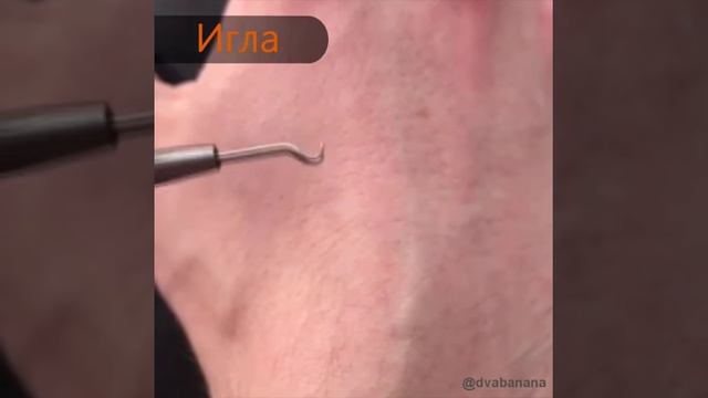 Сравнение китайского экстрактора с немецкимСравнение китайского экстрактора с немецким смотреть онлайн