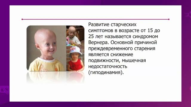 Биология. 10 класс. Старение. Теории о процессе старения /22.01.2021/ смотреть онлайн