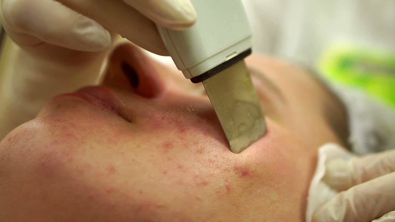 Чистка лица. смотреть онлайн