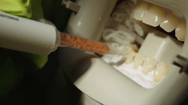 Подробная процедура отбеливания ZOOM 4 WhiteSpeed. Инструкция работы лампой PHILIPS ZOOM4 смотреть онлайн