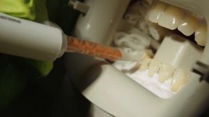 Подробная процедура отбеливания ZOOM 4 WhiteSpeed. Инструкция работы лампой PHILIPS ZOOM4