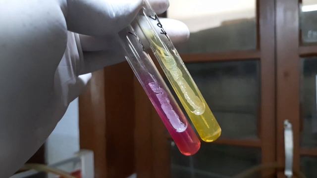 Staphylococcus aureus and Coagulase Negative Staphylococci (CoNS) growth on Mannitol Salt Agar (MSA смотреть онлайн