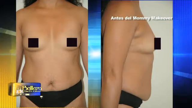 Mommy Makeover 2 - Tu Belleza con Dr. Ronald смотреть онлайн