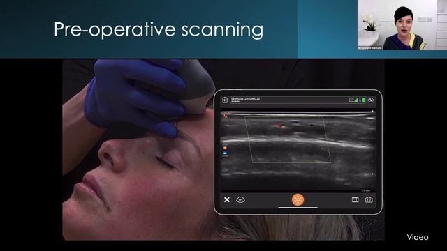 Ultrasound-Guided Techniques To Rapidly Dissolve Fillers, Part 1: Misplaced Facial Fillers