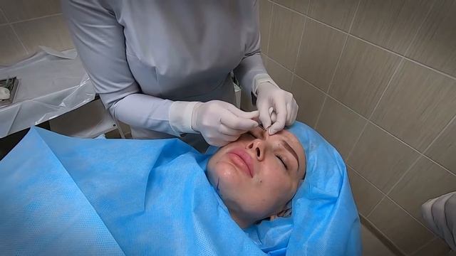 Обучающий мастер класс. Надежда Петраш. Нитевой лифтинг. смотреть онлайн