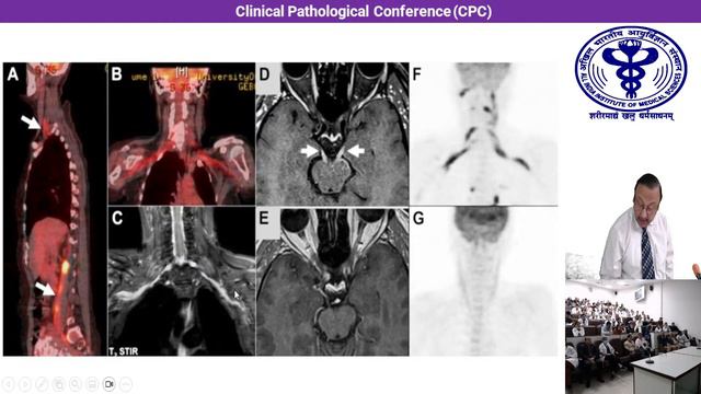 Clinical Discussion : Prof. Devashish & Pathology Discussion : Prof. Vaishali Suri смотреть онлайн