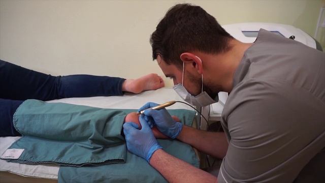 Удаление Стержневой Мозоли смотреть онлайн