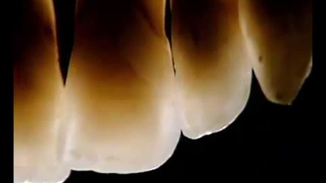 Безметалловая керамика смотреть онлайн