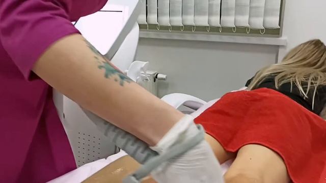 Лазерная эпиляция Сыктывкар смотреть онлайн