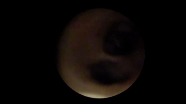 Видео №3 Бронхоскопия и трахеоскопия у собак, слизь в трахеи. смотреть онлайн
