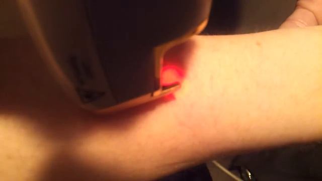 Cutera CoolGlide Excel Laser 12.05-12 смотреть онлайн