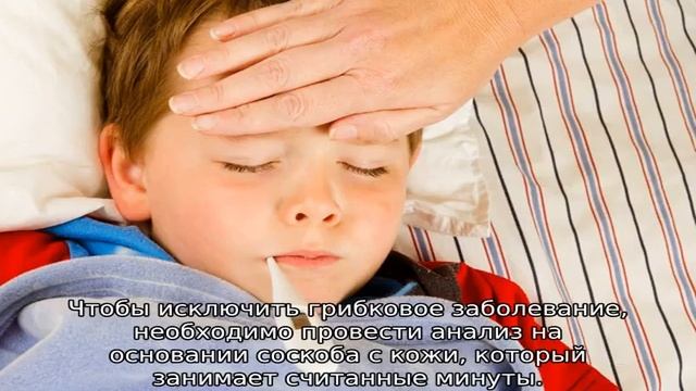 Почему облазит кожа на пальцах ног у ребенка смотреть онлайн
