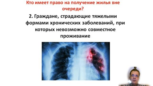 1. Кто имеет право на получение жилья вне очереди? смотреть онлайн