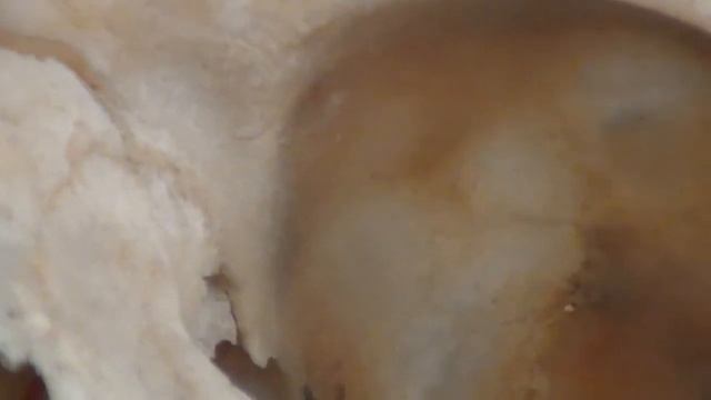 Мышцы глазного яблока